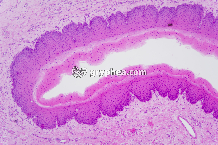 Vagin x25 - gryphea.com